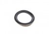 Ремкомплект супорта (переднього) Citroen Jumpy/Fiat Scudo 95-06 (d=60mm)(+ поршен/направляю)(Lucas) FRENKIT 760567 (фото 4)