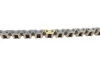 Комплект ланцюга ГРМ Hyundai i20/i30/ix20 1.4/1.6 07-/Kia Rio/Soul 1.4/1.6 11- (z=158) HEPU 21-0413 (фото 2)